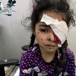 تاکنون ۱۵۰۰ فلسطینی در جنگ غزه بینایی خود را از دست داده‌اند